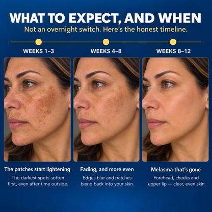 Liposomal Glutathione Capsules | 1000mg Melasma